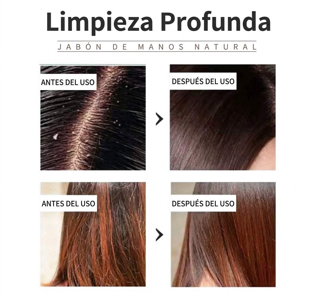 Purite®  -  Pack x 2 Shampoo Sólido de Árbol de Té | Limpieza Profunda Antibacterial
